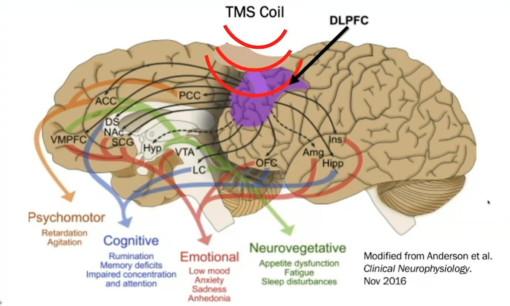 brain